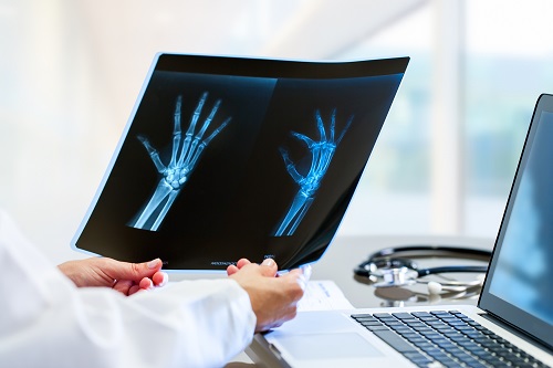 Understanding Trauma Insurance